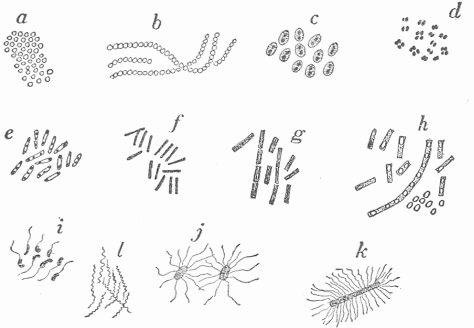 Fig. 17.&mdash;Various Forms Of Bacteria. a, b, c, d, Round bacteria or cocci: (a) Staphylococci, organisms which occur in groups and a common cause of boils; (b) streptococci, organisms which occur in chains and produce erysipelas and more severe forms of inflammation; (c) diplococci, or paired organisms with a capsule, which cause acute pneumonia; (d) gonococci, with the opposed surfaces flattened, which cause gonorrhoea. e, f, g, h, Rod-shaped bacteria or bacilli: (e) diphtheria bacilli; (f) tubercle bacilli; (g) anthrax bacilli; (h) the same bacilli in cultures and producing spores; a small group of spores is shown. (i) Cholera spirill�. (j) Typhoid bacilli. (k) Tetanus bacillus; i, j, k are actively motile, motion being effected by the small attached threads. (l) The screw-shaped spirochite which is the cause of syphilis.