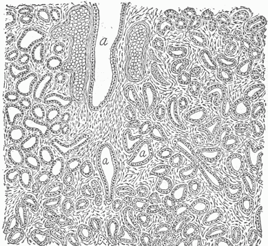 Fig. 5&mdash;A Section Of The Mammary Gland. (a) The ducts of the gland, by which the milk secreted by the cells which line all the small openings, is conveyed to the nipple. All these openings are continuous with the surface of the skin. On each side of the large ducts is a vein filled with blood corpuscles.