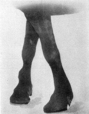 Fig. 29&mdash;Distension of theca of the extensor of the digit
(extensor pedis).