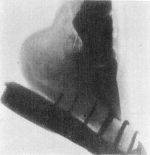 Fig. 39&mdash;Skiagraph of foot. The X-ray offers very limited
possibilities in the diagnosis of lameness. The location of a ''gravel''
or a nail that had worked its way some distance from the surface, or of
an abscess of some proportion, deep in the tissues, might be facilitated
under some circumstances by the aid of the X-ray. Its use in the
detention of fractures is very limited, owing to the difficulty
encountered in getting a view from the right position&mdash;many trials being
necessary in most cases. The case shown above was diagnosed clinically
as incipient ringbone. The X-ray revealed no lesions. (Photo by L.
Griessmann.)
