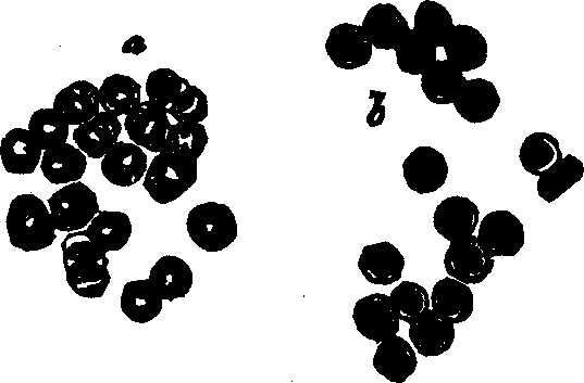 Illustration:
Fig. 38. Red corpuscles of human blood, 