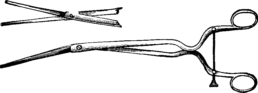 Illustration:
Fig. 5.  STOHLMAN'S HYSTEROTOME.  This instrument has two cutting blades
which shut past each other, as seen in the lower figure, so as not to cut
when introduced into the canal of the uterine neck. After introduction, the
cutting blades are separated, as shown in the upper figure, the extent of
the incision being regulated by the thumb-screw attached to the handles, as
represented in the lower figure.