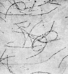 Granule Bacillus from Yoghourt. Cultivated in Skim Milk in Twenty-Four Hours