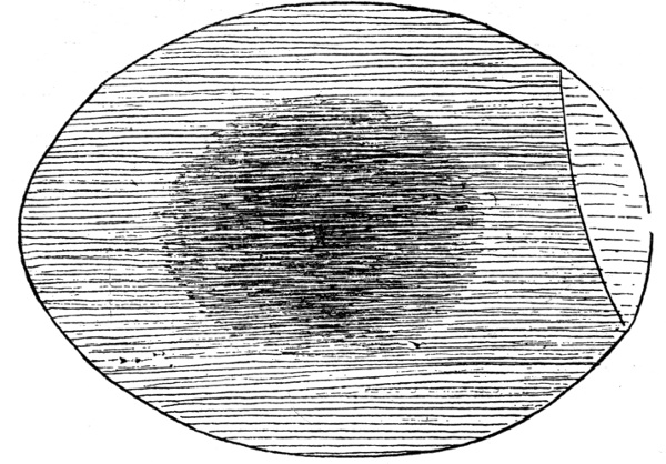 Figure 5.&mdash;Egg at End of 120 Hours.