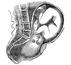  head
fixed at the upper strait
